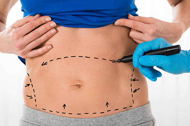 Is Body Jet Liposuction Right for a Clean, Smooth Result