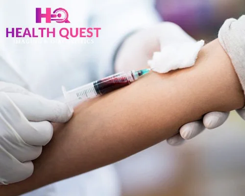 Blood sample collection procedure at Health Quest Imaging & Diagnostics, showing a healthcare professional drawing blood from a patient's arm for laboratory testing.