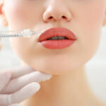 Are Lip Fillers Injection Treatments Suitable for All Ages