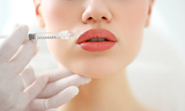 Are Lip Fillers Injection Treatments Suitable for All Ages