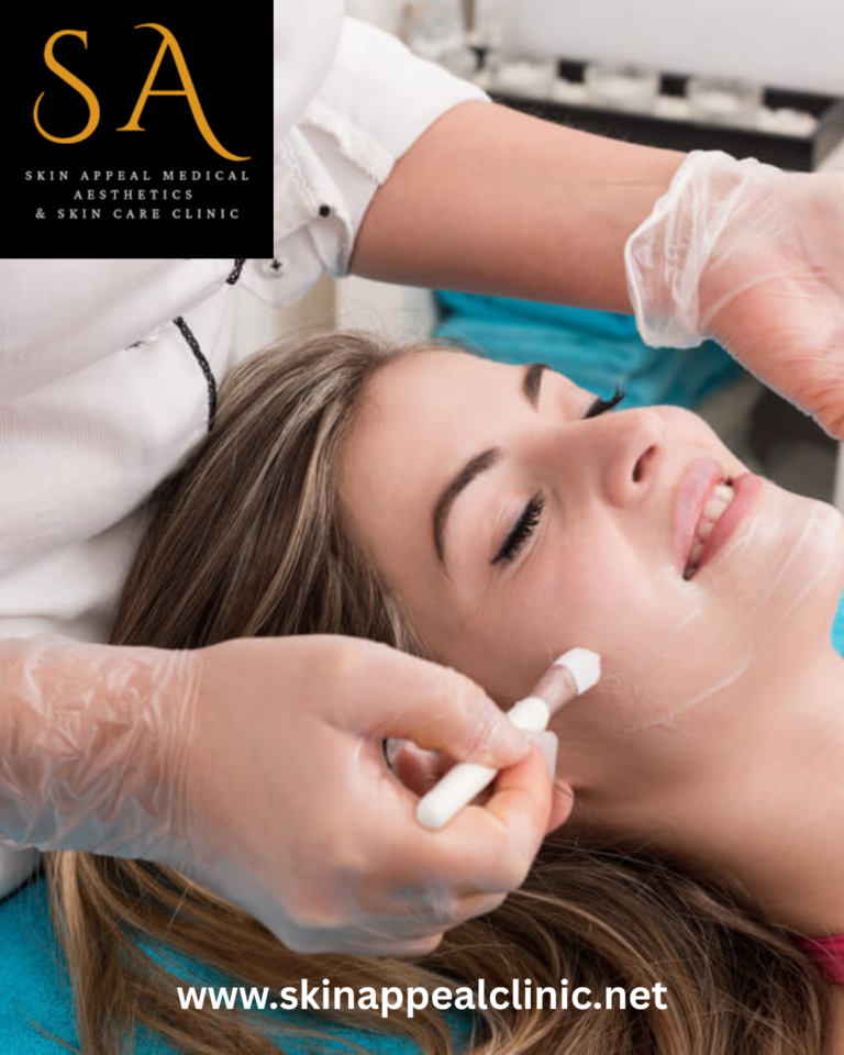 Blemish control treatments Liverpool