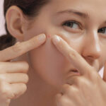 Can Acne Treatment Provide Natural-Looking and Clear Skin Results