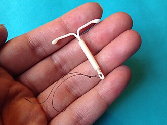 Can Contraception Treatment Fit Your Lifestyle