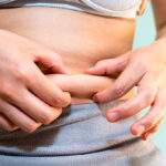 Can Fat Reduction Treat Small Pockets of Fat