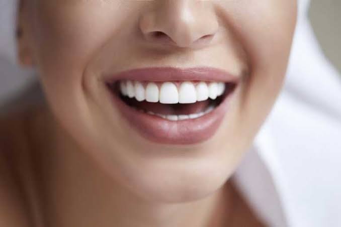 Dental Veneers in Hamilton, ON improving stained, chipped, uneven, and worn teeth with natural-looking cosmetic results