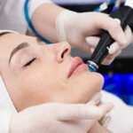 Does HydraFacial Help Reduce Fine Lines