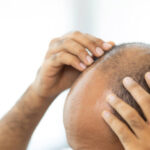 Is GFC Treatment for Hair Suitable for Early Hair Loss