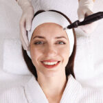 Is Microneedling for Acne Scars Painful or a Comfortable Procedure
