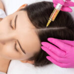 Is PRP Hair Treatment Suitable for Sensitive Scalps