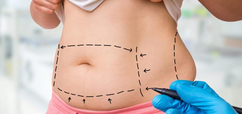 Plastic-surgery-doctor-draw-li-e1672254583109-1024x484