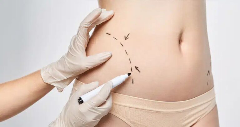 Body Contouring in Dubai: How to Achieve Natural and Balanced Results