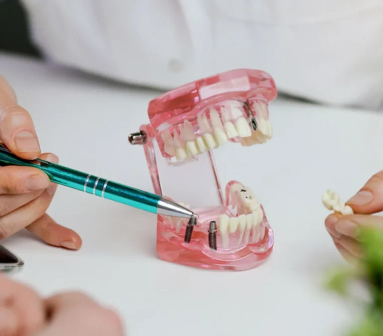 my glow up dentistry