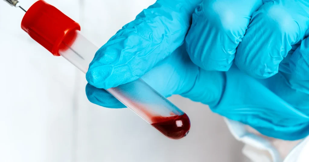 doctor-in-blue-gloves-keep-in-hands-test-tube-with-2023-11-27-05-29-14-utc-scaled-e1738586694475