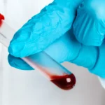 doctor-in-blue-gloves-keep-in-hands-test-tube-with-2023-11-27-05-29-14-utc-scaled-e1738586694475