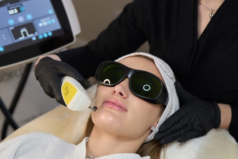 Ipl photofacial