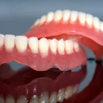 Immediate Dentures