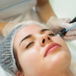 Can Dermapen Treatment smooth rough skin