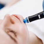 Can HydraFacial Help Brighten a Dull Complexion