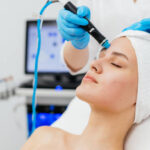 Can HydraFacial reduce blackheads effectively