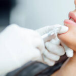Can Lip Fillers Injection Boost Self-Confidence