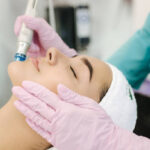 Can Microdermabrasion Treatment Improve Skin Smoothness