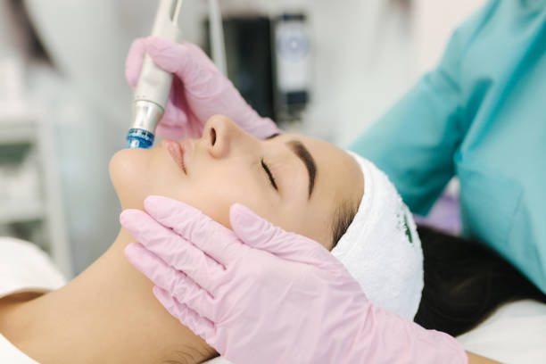 Can Microdermabrasion Treatment Improve Skin Smoothness