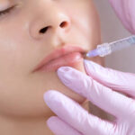 Can Russian Lip Fillers boost self-confidence