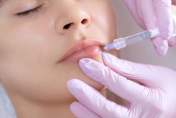 Can Russian Lip Fillers boost self-confidence