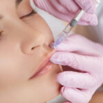 Does Lip Fillers Injection Look Natural Over Time