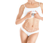 Does Liposuction Improve Natural Body Symmetry