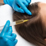 Does PRP Hair Treatment Deliver Natural Results