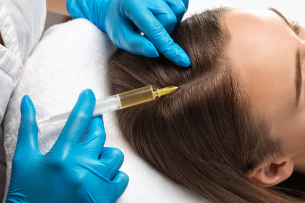 Does PRP Hair Treatment Deliver Natural Results