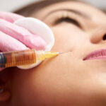 How Long Do Cheek Fillers Injections Last