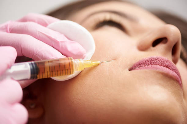 How Long Do Cheek Fillers Injections Last
