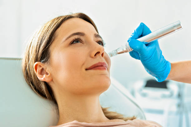 How Many Sessions of Dermapen Treatment Are Needed