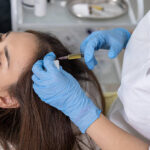 How Many Sessions of PRP Hair Treatment Are Needed