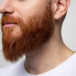 Is Beard Transplant suitable for young men