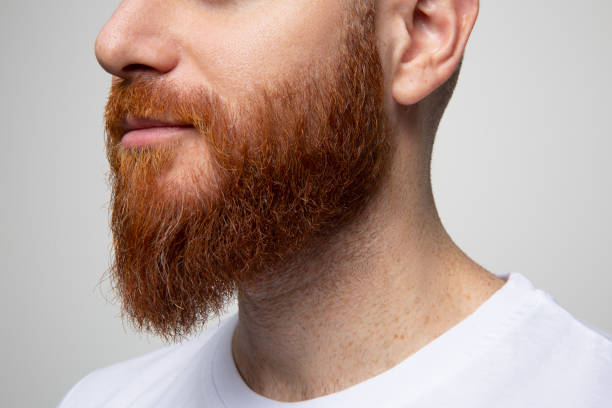 Is Beard Transplant suitable for young men