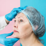 Is Facelift Effective for Loose Facial Skin