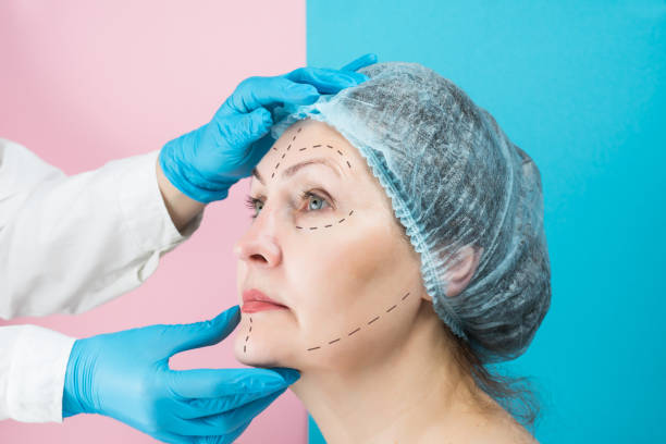 Is Facelift Effective for Loose Facial Skin