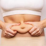 Is Mini Abdominoplasty the best treatment for you
