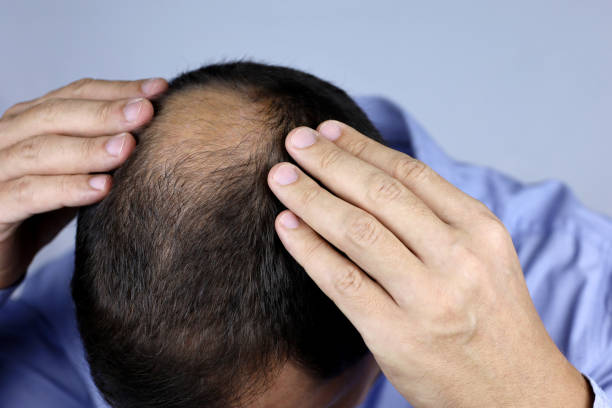 Is a Trichologist right for thinning hair