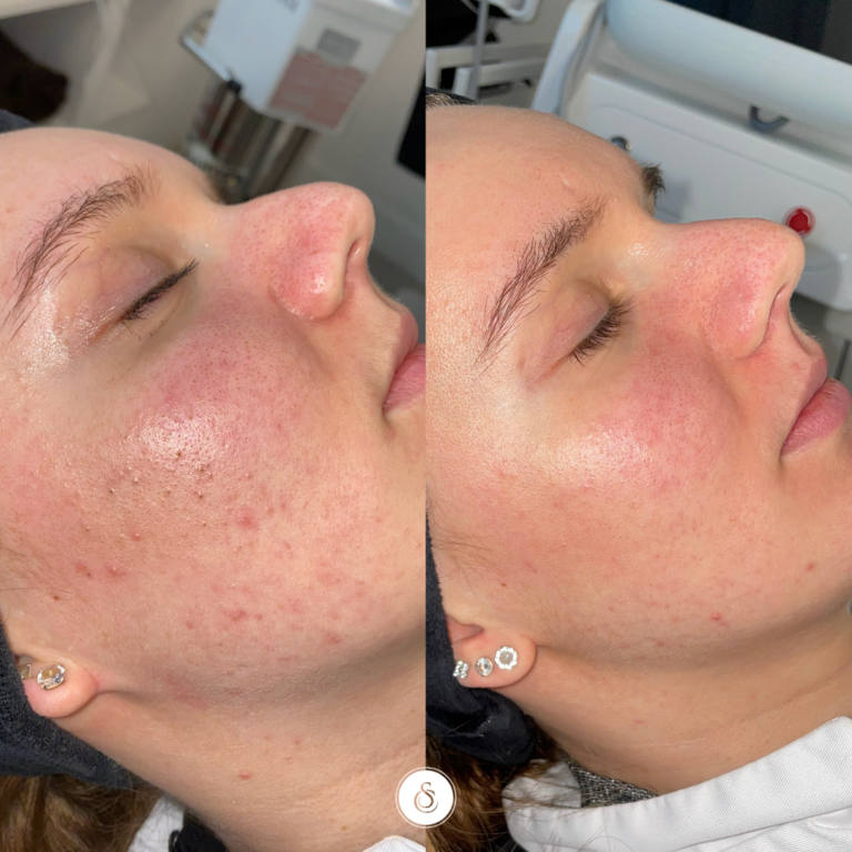 Menopause skin treatment clinic