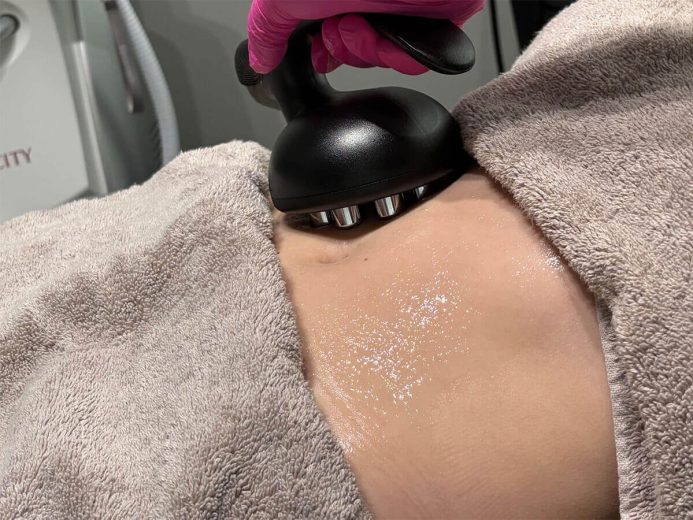RF body contouring Edmonton