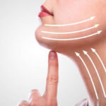 What Are the Benefits of Modern Facelift Surgery