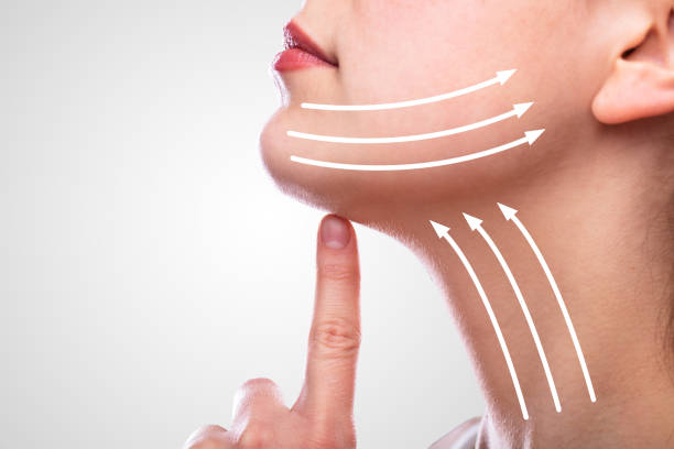 What Are the Benefits of Modern Facelift Surgery