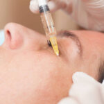 What Can PRP Treatment in Abu Dhabi Do for Under-Eye Bags