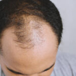 What Makes GFC Treatment for Hair Effective