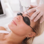 Who Is the Best Candidate for Pico Laser