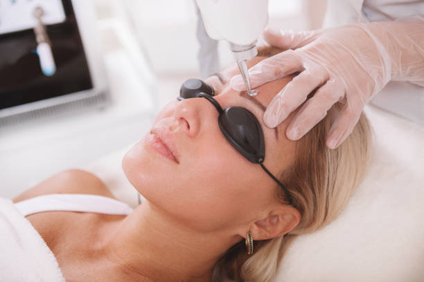 Who Is the Best Candidate for Pico Laser